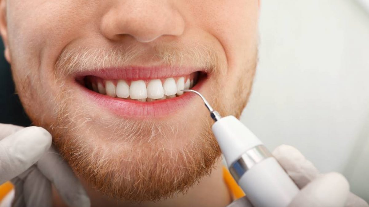 Tartre Sur Les Dents Comment S En Debarrasser Ou Le Prevenir