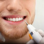 Comment-Se-Debarasser-Sur-Les-Dents-Du-Tartre