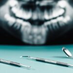 Les outils d’un dentiste face à une radiographie dentaire.