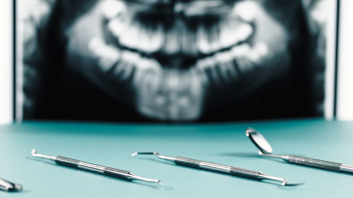 Les outils d’un dentiste face à une radiographie dentaire.