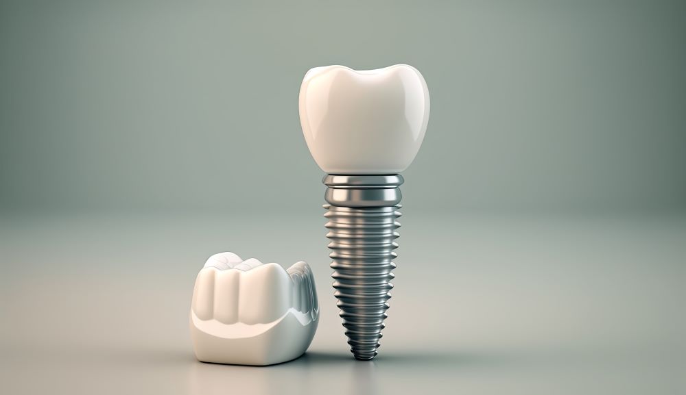 Différences entre un implant dentaire et une couronne dentaire