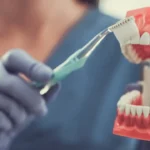 comment enlever plaque dentaire